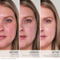 HydroPure™ Colour Correcting Serum with Hyaluronic Acid & CoQ10 - Crystal Clear Skin Management