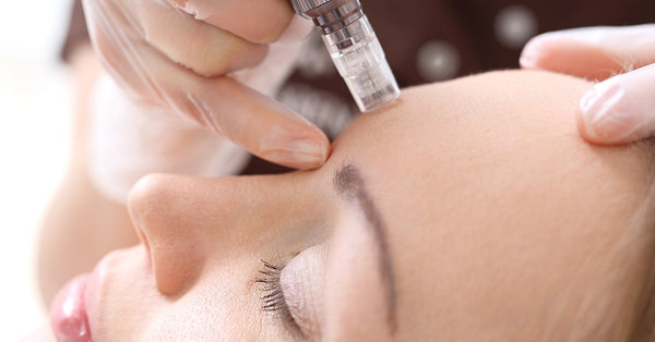 dermal needling